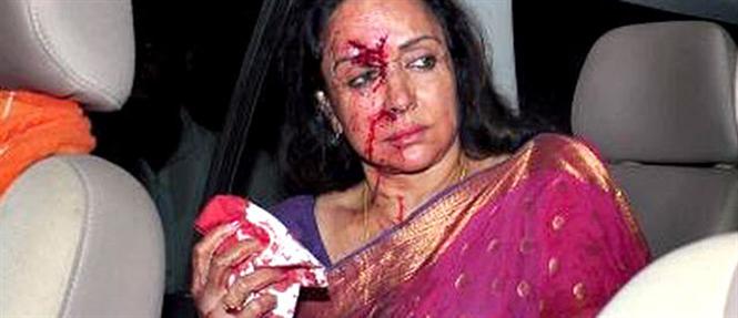 Hema Malini injured in road accident in Rajasthan
