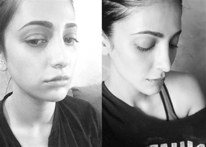 Shruthi Haasan opens up on Hormonal Issues & Plastic Surgery!